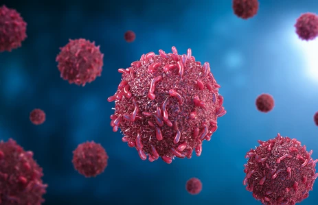 Medical illustration of recurrent and advanced cancer cells treated by a head and neck cancer surgeon in Ahmedabad.
