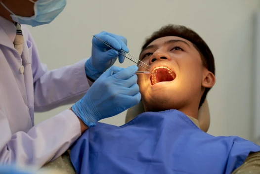 Patient undergoing oral examination for maxillofacial prosthesis planning and oral cancer rehabilitation in Ahmedabad