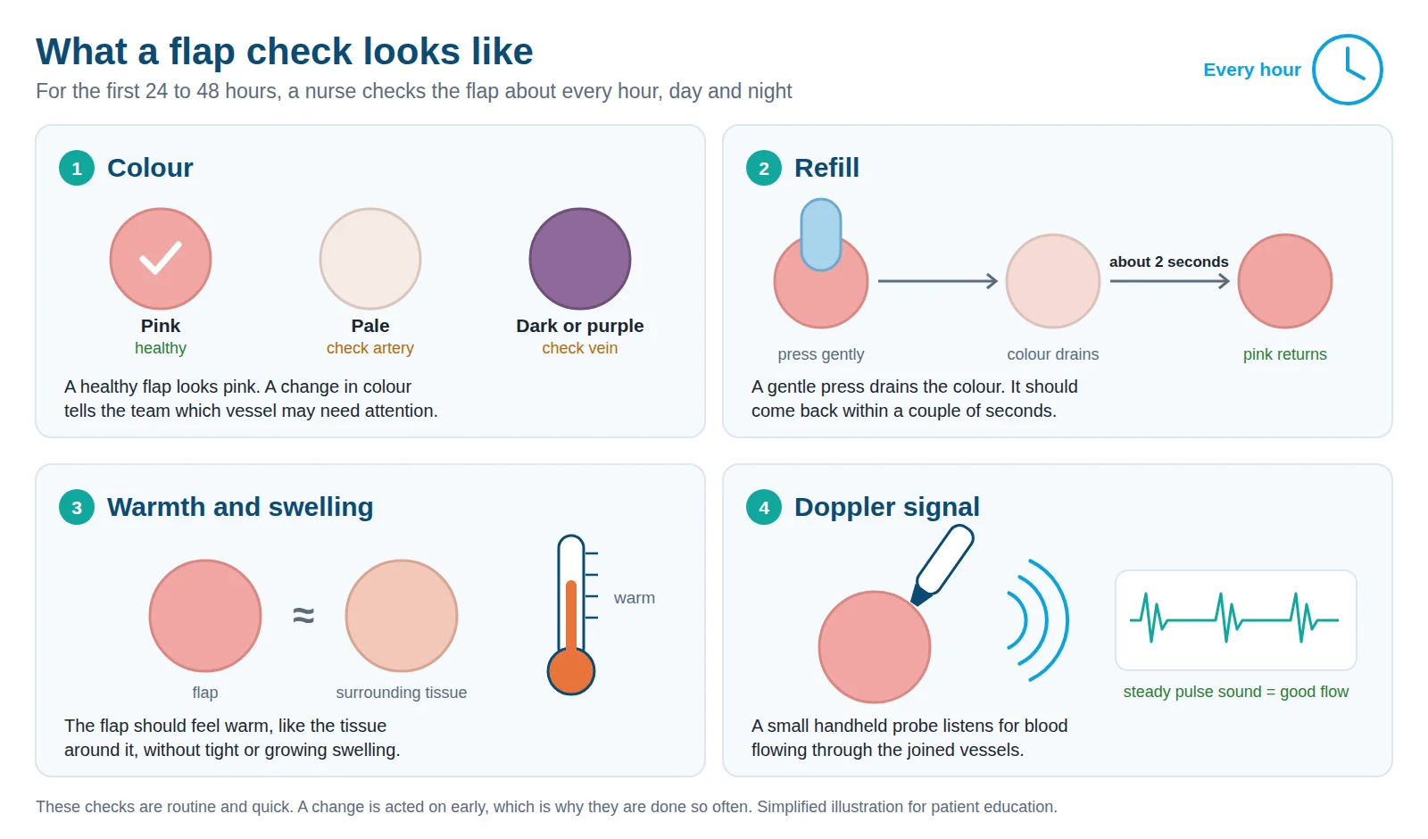 Illustration of the four checks a nurse makes on a free flap: colour, refill, warmth and Doppler signal.